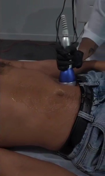 Fat cavitation treatment on a client's stomach